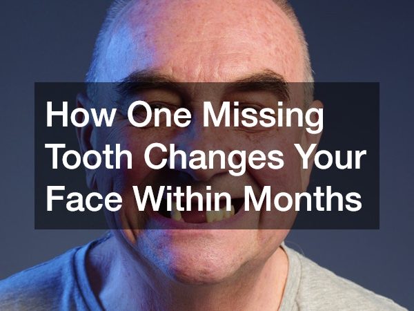 How One Missing Tooth Changes Your Face Within Months