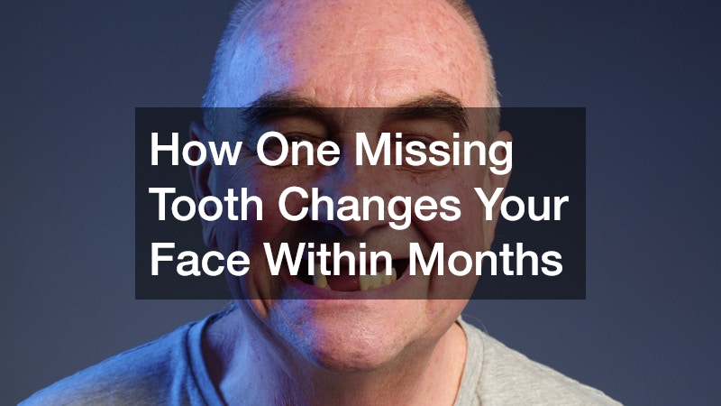 How One Missing Tooth Changes Your Face Within Months